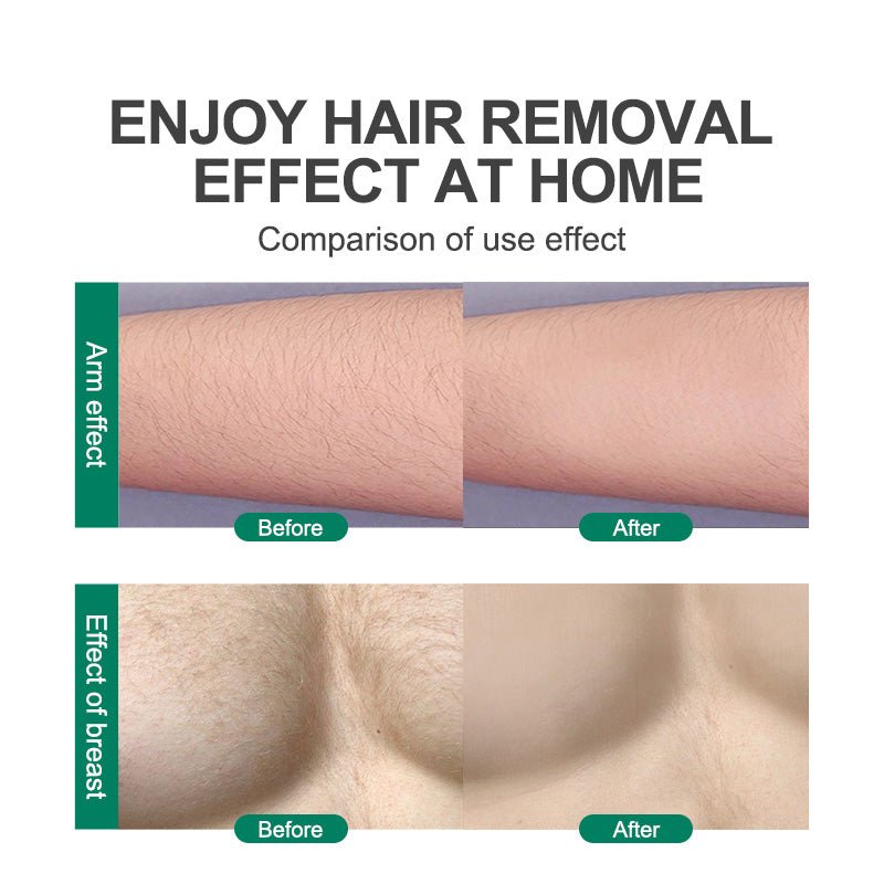CJEER SilkSmooth Hair Remover - TrendStorm Haven