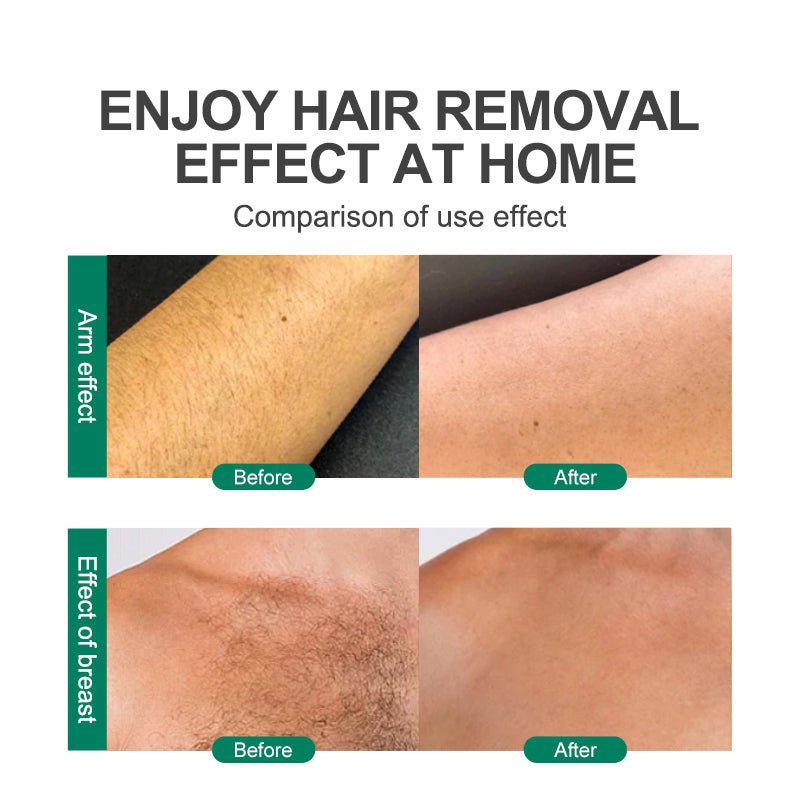 CJEER SilkSmooth Hair Remover - TrendStorm Haven